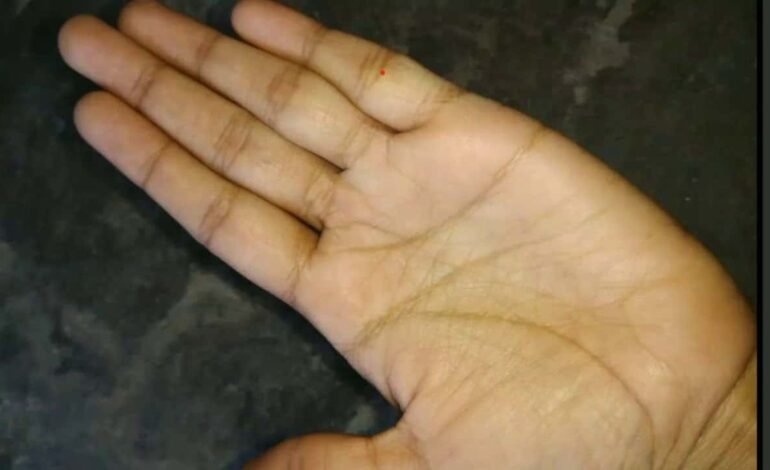 palmistry